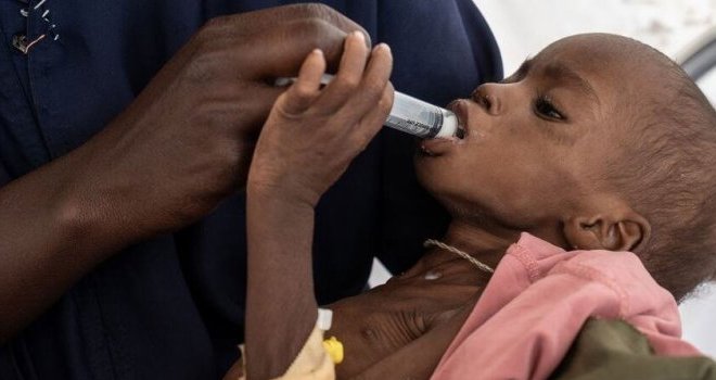 La faim dans le monde est concentrée dans seulement dix pays
